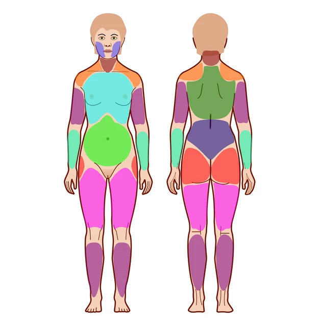 Fibromialgija