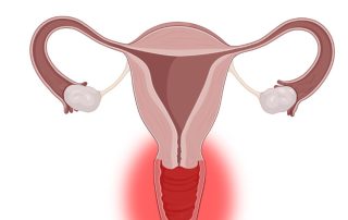 Vaginitas