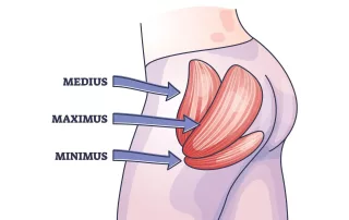 Giliųjų sėdmens raumenų sindromas