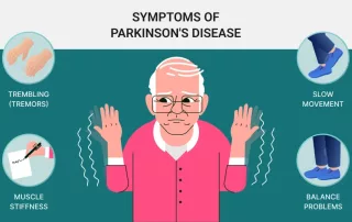 Parkinsono liga