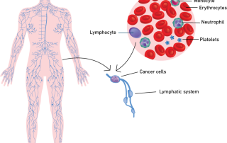 Limfoma