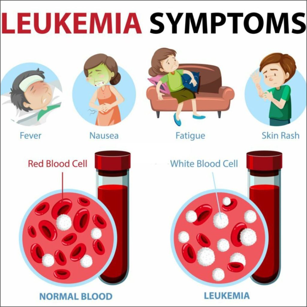 Leukemija