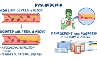 Dislipidemija