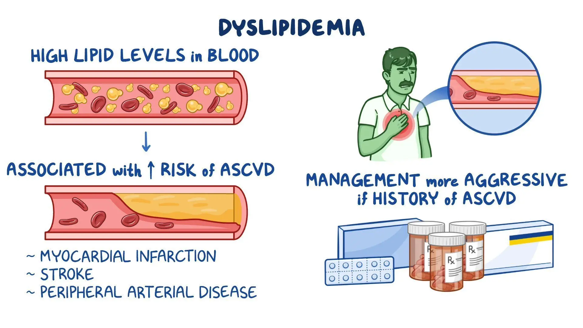 Dislipidemija