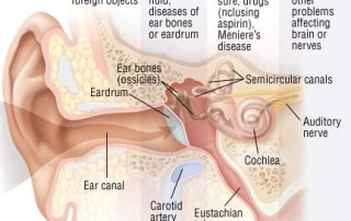 Ūžesys ausyje (Tinnitus)