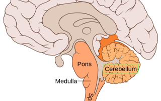 Vestibulinės funkcijos sutrikimas (vestibulopatija): gerybinis paroksizminis pozicinis galvos svaigimas, vestibulinis neuronitas
