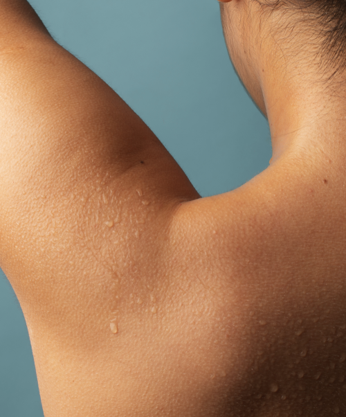 Padidėjusio prakaitavimo ištyrimo programa