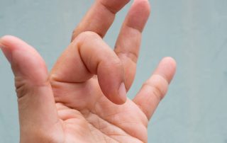ERGOTERAPIJA TURINT SPRAGSINTĮ PIRŠTĄ