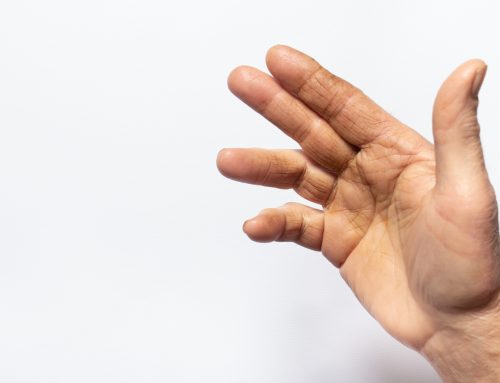 Apsaugota: ERGOTERAPIJA ESANT DIUPITRENO KONTRAKTŪRAI